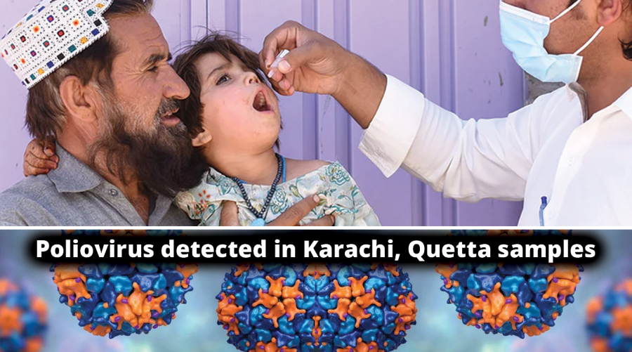Poliovirus detected in Karachi, Quetta samples