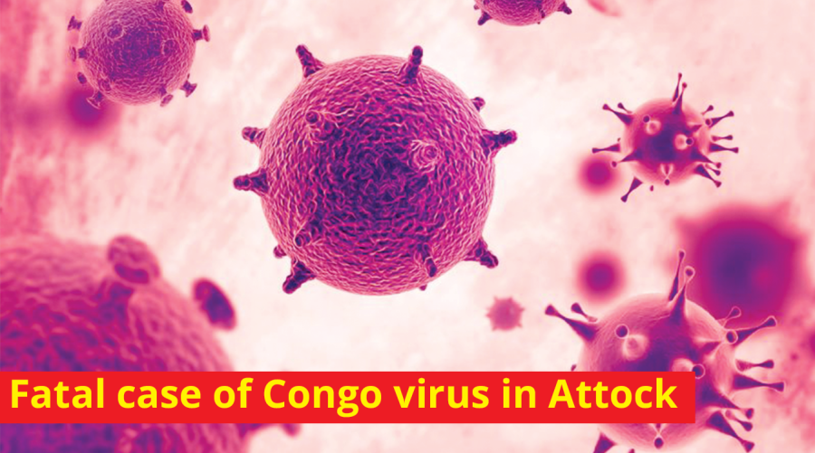 Fatal case of Congo virus in Attock