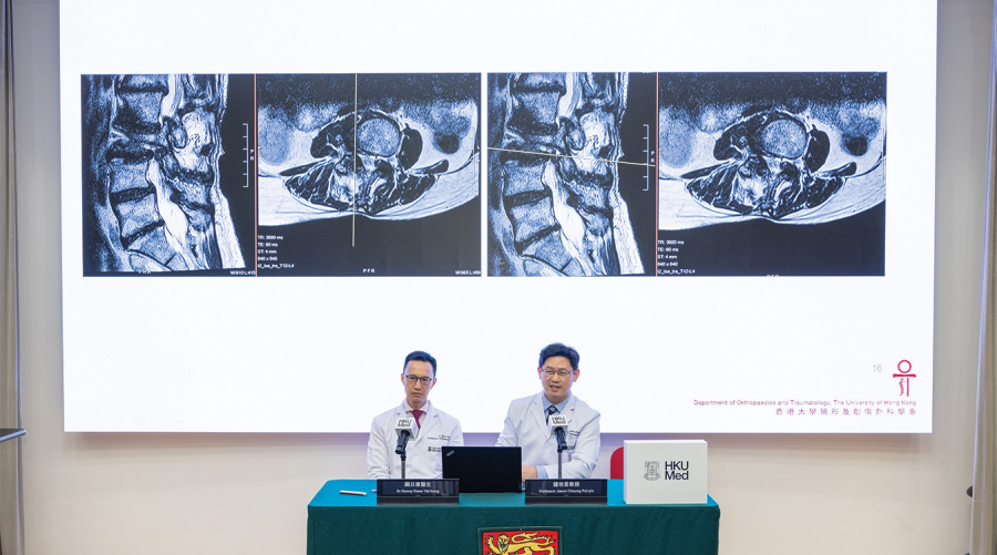 Hong Kong varsity introduces robot-assisted spine surgery