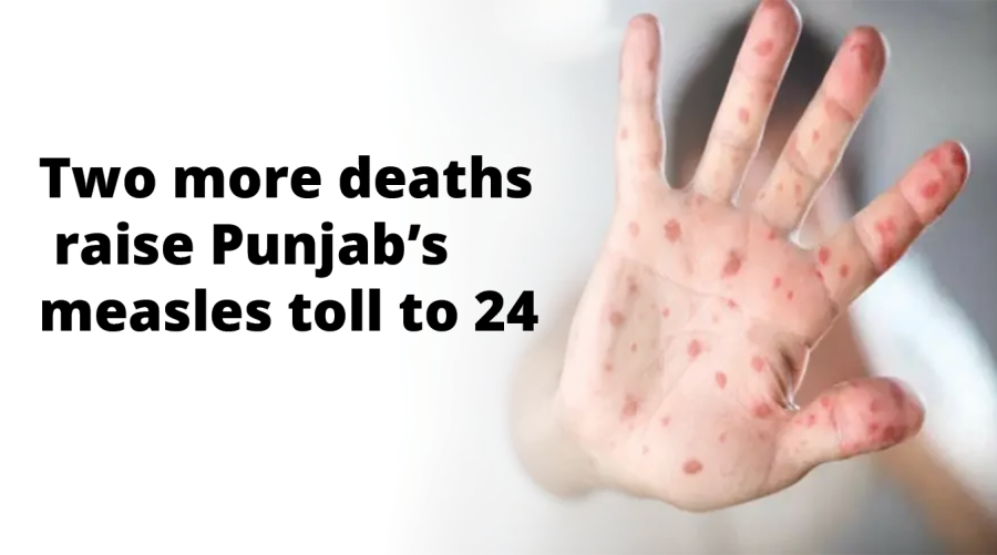 Two more deaths raise Punjab’s measles toll to 24