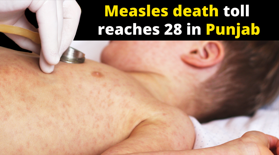 Measles death toll reaches 28 in Punjab