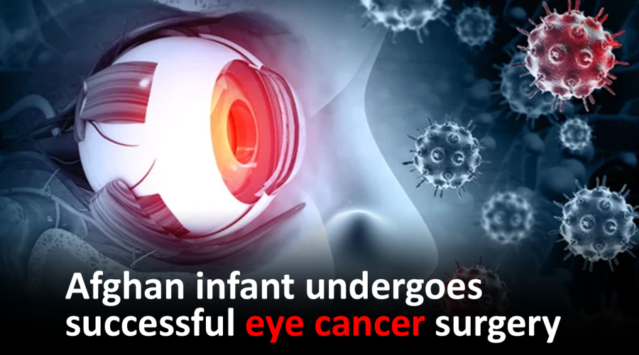 Afghan infant undergoes successful eye cancer surgery 