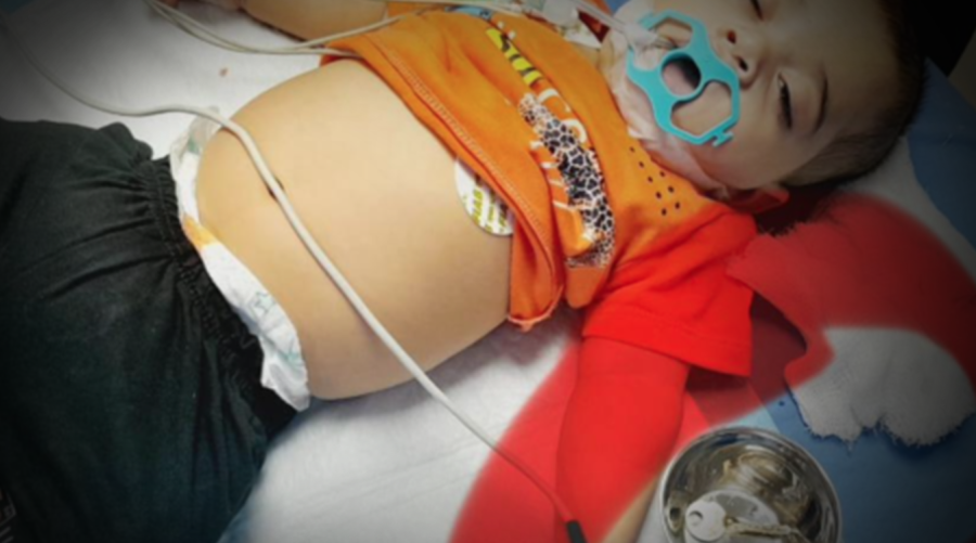 LGH medics remove key from kid’s stomach 