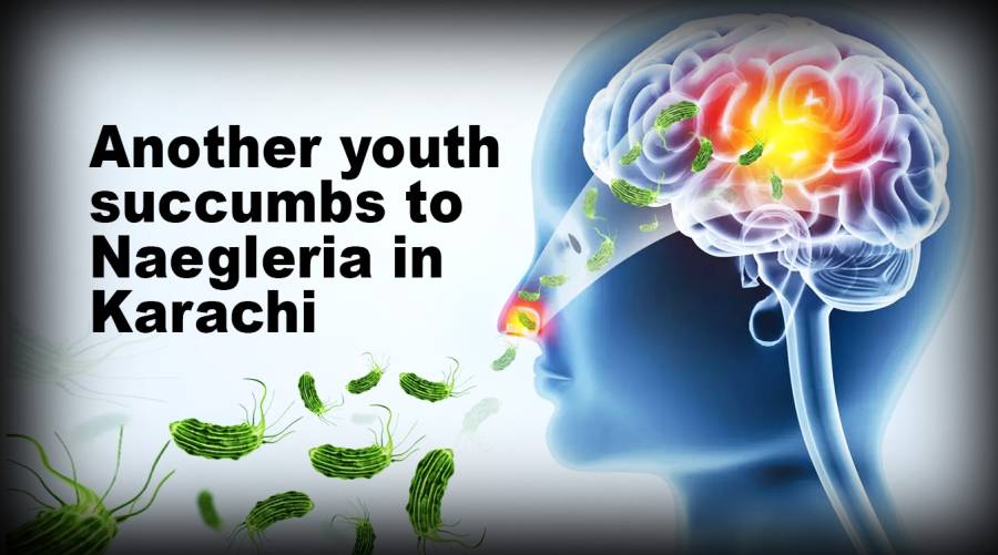 Another youth succumbs to Naegleria in Karachi