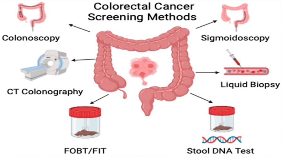 Breakthrough colorectal cancer test aims to replace invasive colonoscopies